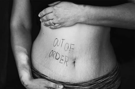 Τι κάνουμε με το ευερέθιστο έντερο επιτέλους;